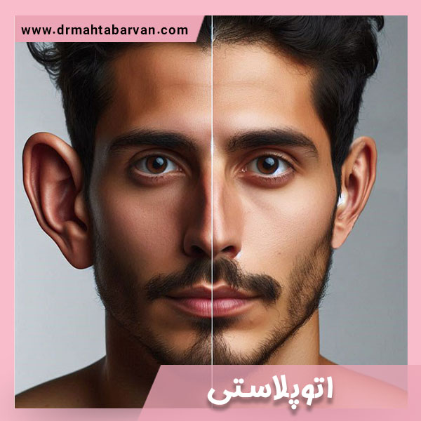اتوپلاستی - دکتر مهتاب آروان
