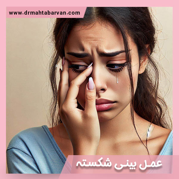 جراحی بینی شکسته - دکتر مهتاب آروان