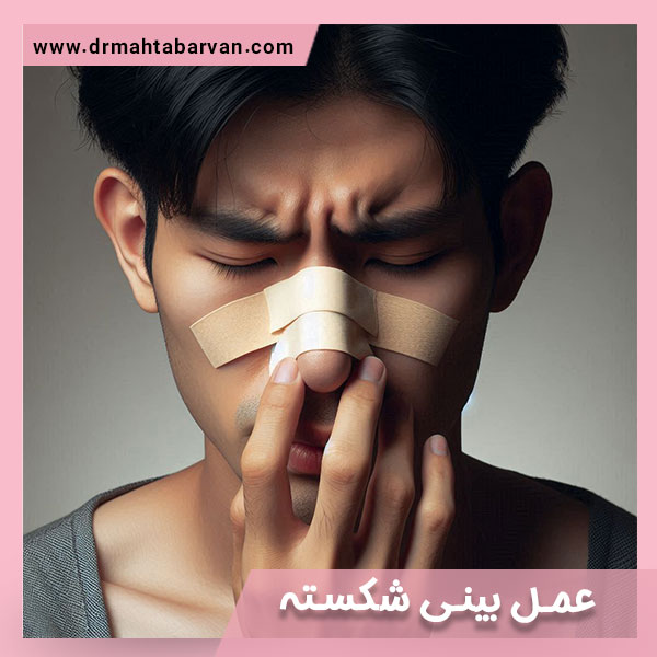 جراحی بینی شکسته - دکتر مهتاب آروان