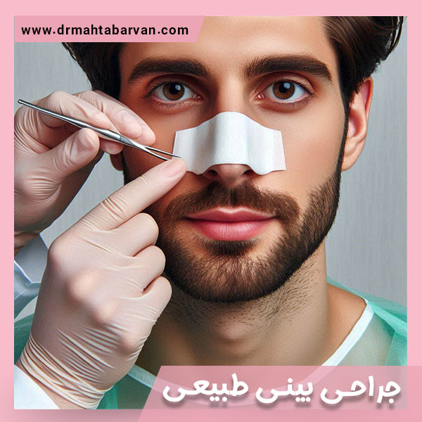 جراحی بینی طبیعی - دکتر مهتاب آروان